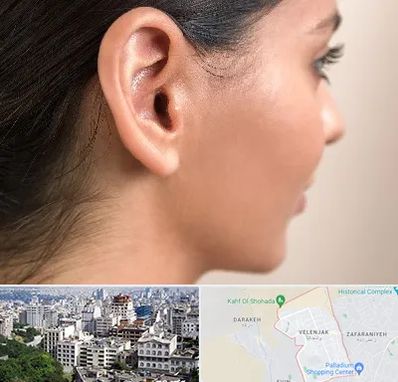 عمل گوش بل در ولنجک 