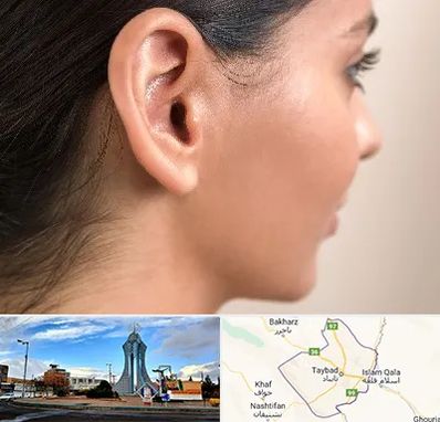 عمل گوش بل در تایباد