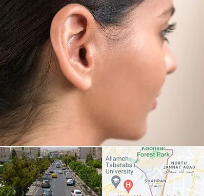 عمل گوش بل در شهران 