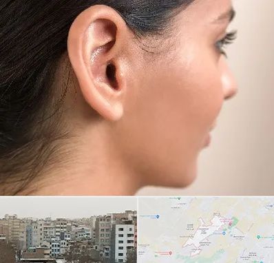 عمل گوش بل در محمد شهر کرج