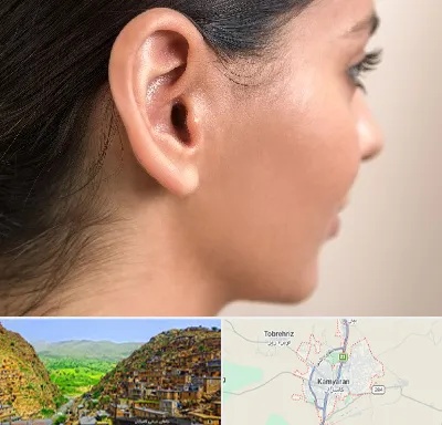 عمل گوش بل در کامیاران