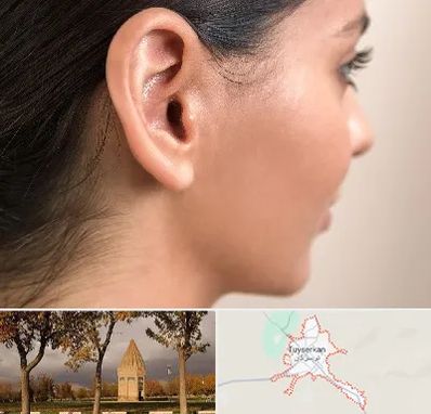 عمل گوش بل در تویسرکان