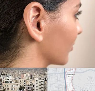 عمل گوش بل در اسکندری