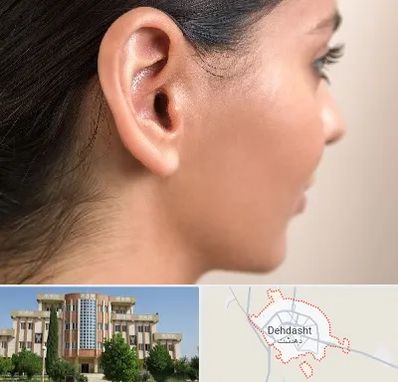 عمل گوش بل در دهدشت