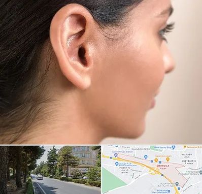 عمل گوش بل در مهرویلا کرج