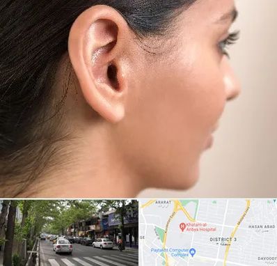 عمل گوش بل در ظفر 