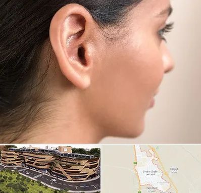 عمل گوش بل در شاهین شهر