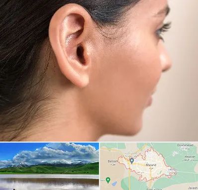 عمل گوش بل در مرند