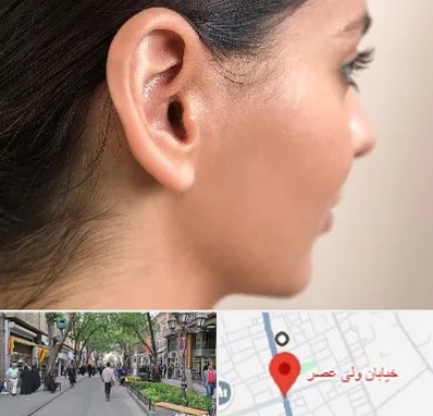 عمل گوش بل در ولیعصر شهریار