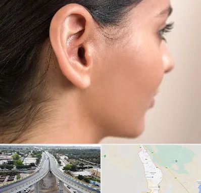 عمل گوش بل در اندیمشک