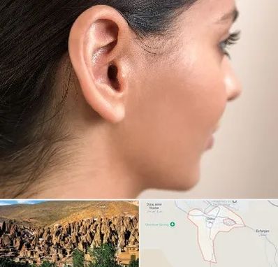 عمل گوش بل در اسکو