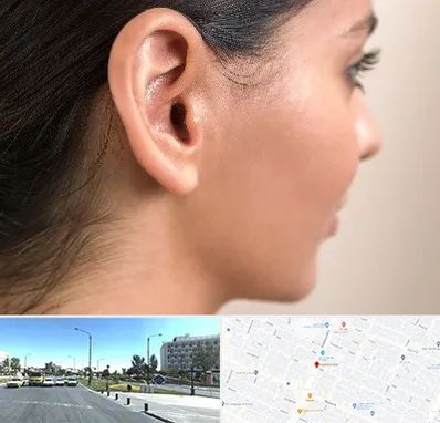 عمل گوش بل در بلوار کلاهدوز مشهد