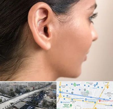 عمل گوش بل در فرجام