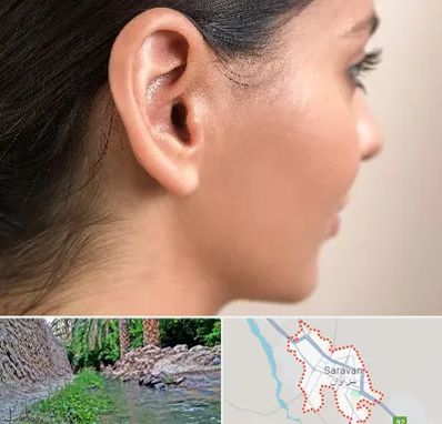 عمل گوش بل در سراوان
