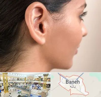 عمل گوش بل در بانه