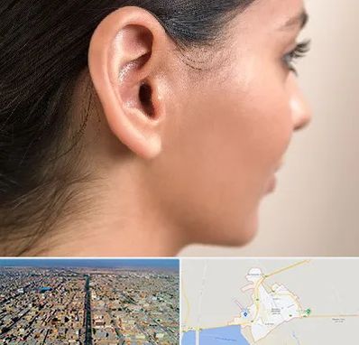 عمل گوش بل در بندر ماهشهر