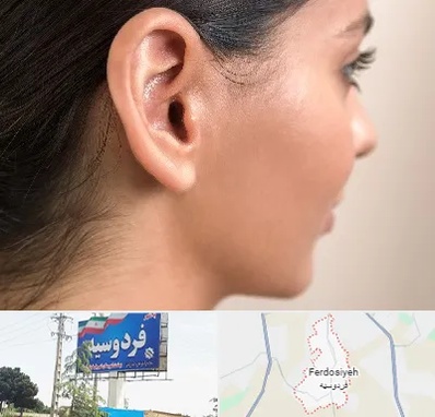عمل گوش بل در فردوسیه شهریار