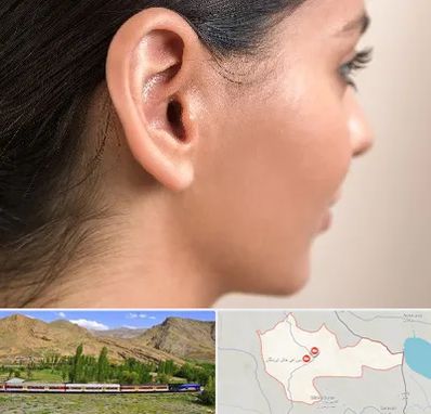 عمل گوش بل در خاش