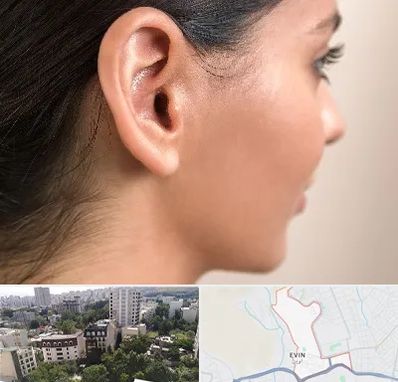 عمل گوش بل در اوین