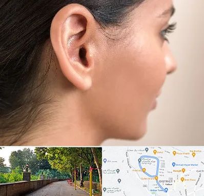 عمل گوش بل در بلوار گیلان رشت