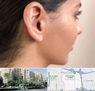 عمل گوش بل در آپادانا