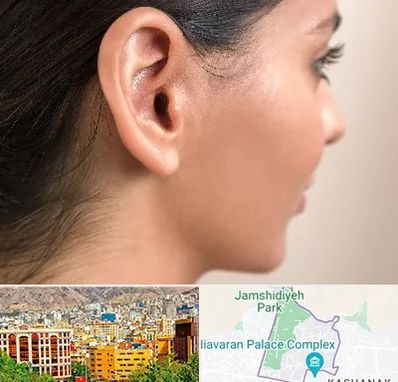 عمل گوش بل در نیاوران 