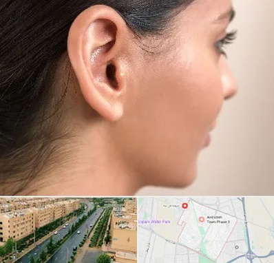 عمل گوش بل در فاز سه اندیشه