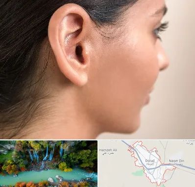 عمل گوش بل در دورود