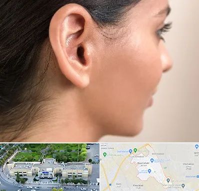 عمل گوش بل در نسیم شهر