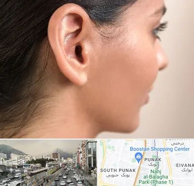 عمل گوش بل در پونک 