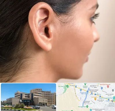 عمل گوش بل در صیاد شیرازی مشهد