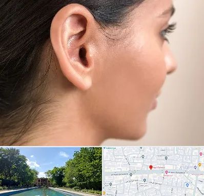 عمل گوش بل در هشت بهشت اصفهان