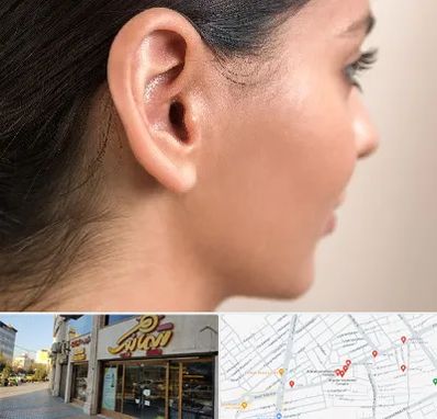 عمل گوش بل در عطاران قم