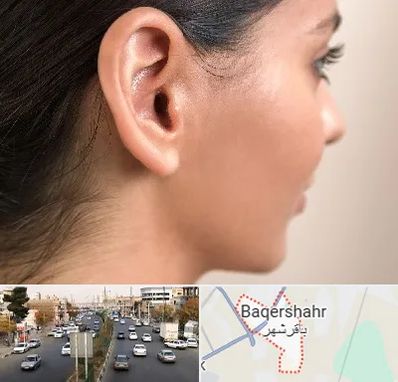 عمل گوش بل در باقرشهر