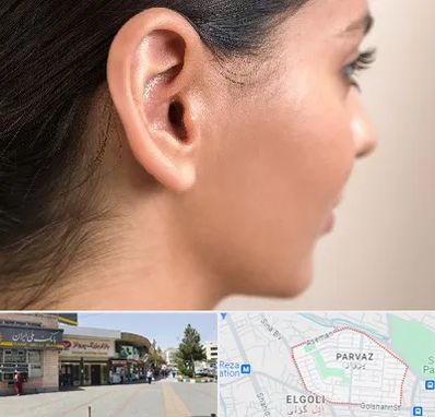 عمل گوش بل در پرواز تبریز