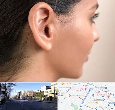 عمل گوش بل در خیابان ملاصدرا شیراز