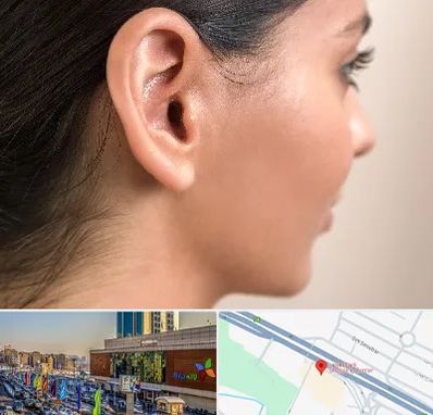 عمل گوش بل در لاله پارک تبریز