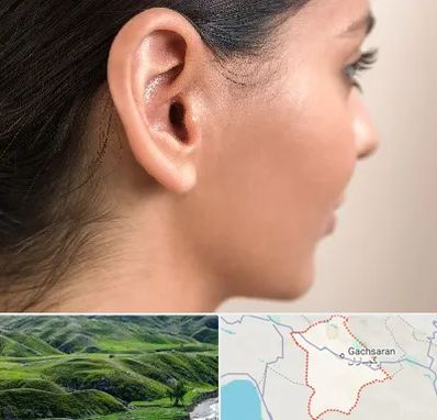 عمل گوش بل در گچساران