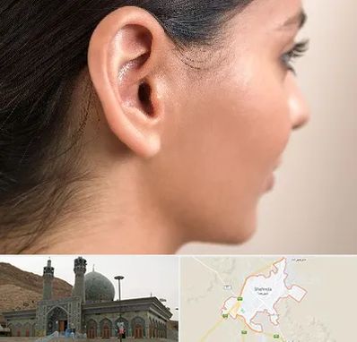 عمل گوش بل در شهرضا