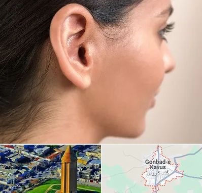 عمل گوش بل در گنبد کاووس