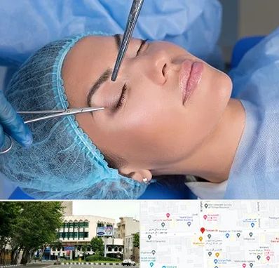 جراحی لیفت ابرو در طالقانی 