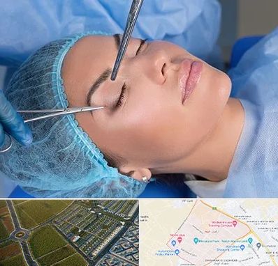 جراحی لیفت ابرو در الهیه مشهد