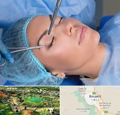 جراحی لیفت ابرو در بروجرد