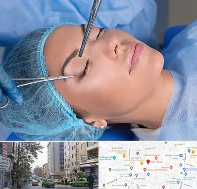 جراحی لیفت ابرو در فاطمی 