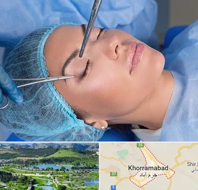 جراحی لیفت ابرو در خرم آباد