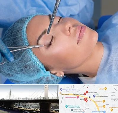 جراحی لیفت ابرو در پارک وی 