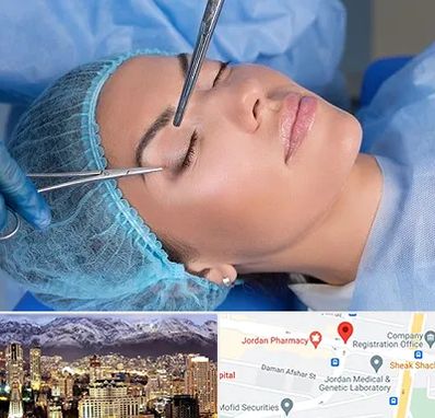 جراحی لیفت ابرو در جردن 
