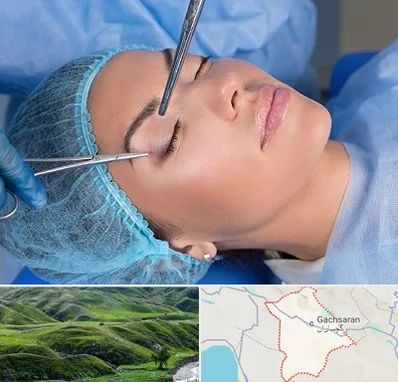 جراحی لیفت ابرو در گچساران
