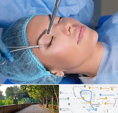 جراحی لیفت ابرو در بلوار گیلان رشت