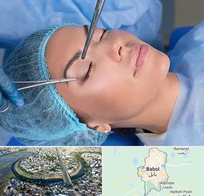 جراحی لیفت ابرو در بابل